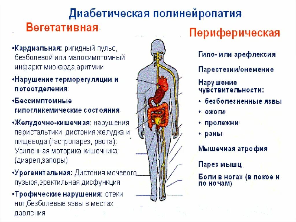 Терапия схема диабетическая полинейропатия. Полинейропатия осложнение сахарного диабета. Схема терапии полинейропатии диабетической. Диабетическая полинейропатия нижних конечностей синдромы.