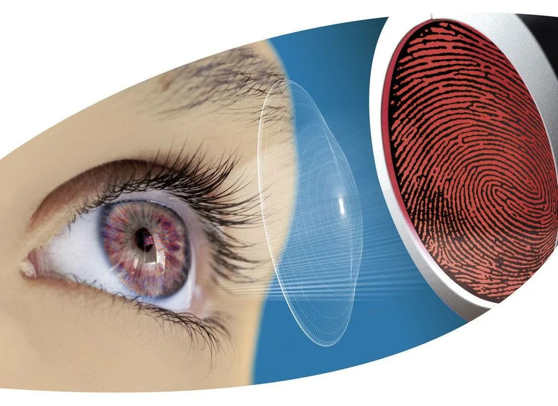 Как можно скорректировать зрение при помощи линз. Ночные ортокератологические линзы. Ортокератология ночные линзы. Ортокератологическая контактная линза это. Линзы корректирующие зрение.