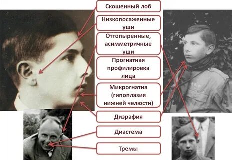Узнай какой ты преступник по системе ломброзо