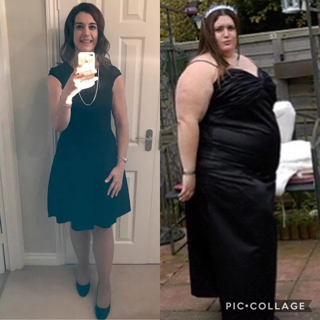 Толстые до и после похудения. Кожа после сильного похудения. 100 кг похудеть. 100 кг похудеть. Женщина похудела.