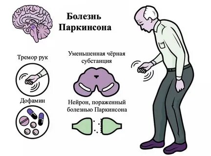 Причины человеческих ошибок