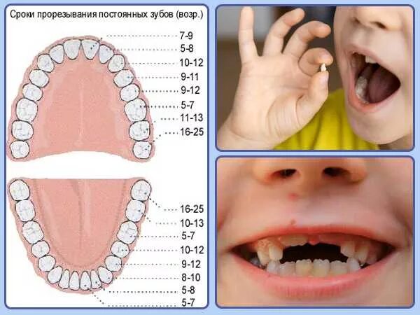 4 года зубы выпадают. Смена молочных зубов. Молочные зубы у детей. Схема постоянных зубов у детей. У детей выпадают молочные зубы схема.