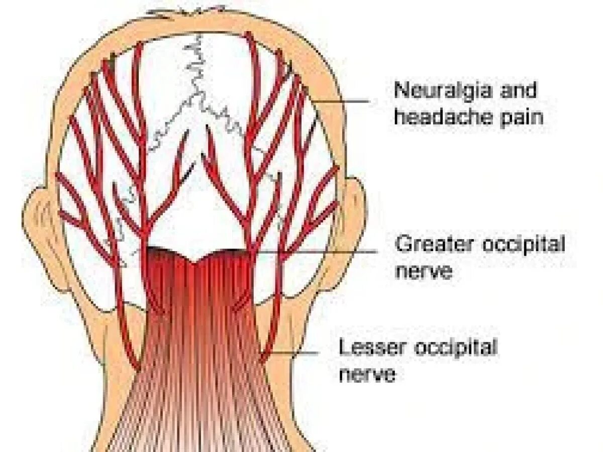 Neuralgia латынь