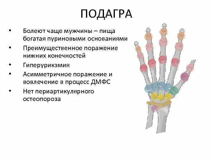 Подагра болезнь королей. Подагра болезнь королей и аристократов. Кто чаще болеет подагрой. Почему болезнь королей