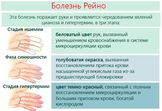 Онемение мизинца и безымянного пальцев. Руки затекают и немеют. Причины онемения левой руки левой ноги. Причины онемения левой руки левой ноги. Причины онемения левой руки левой ноги.