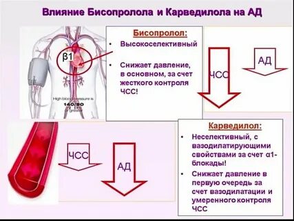 Снижение давления операция
