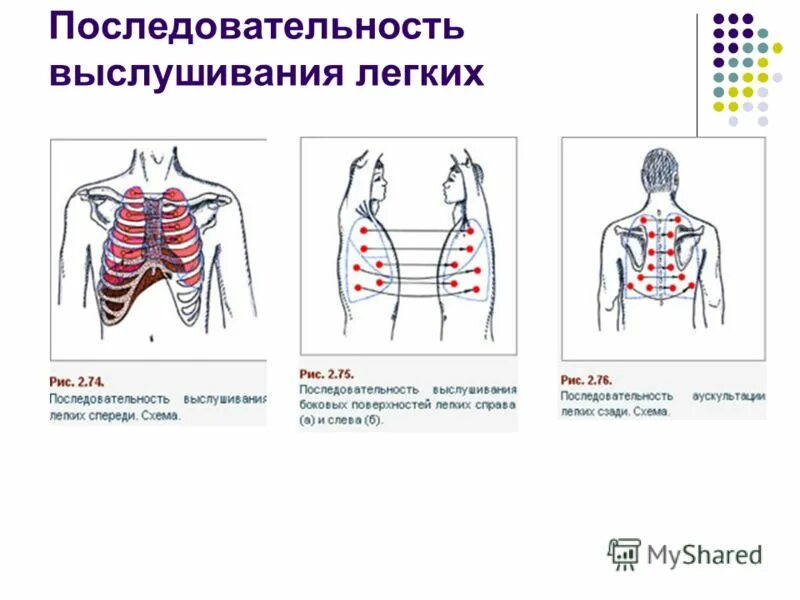 инструмент для выслушивания сердца органов дыхания. места выслушивания клапанов сердца анатомия. проекция клапанов сердца и места их выслушивания. инструмент для выслушивания сердца органов дыхания. понятие аускультация.