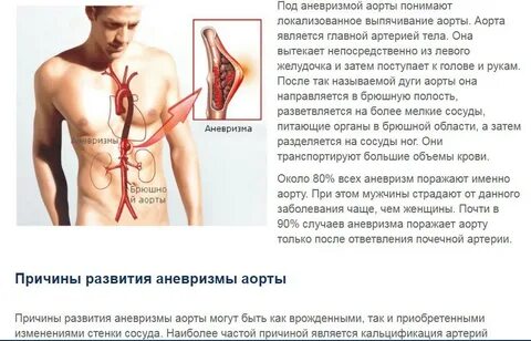 Народные средства лечения аорты