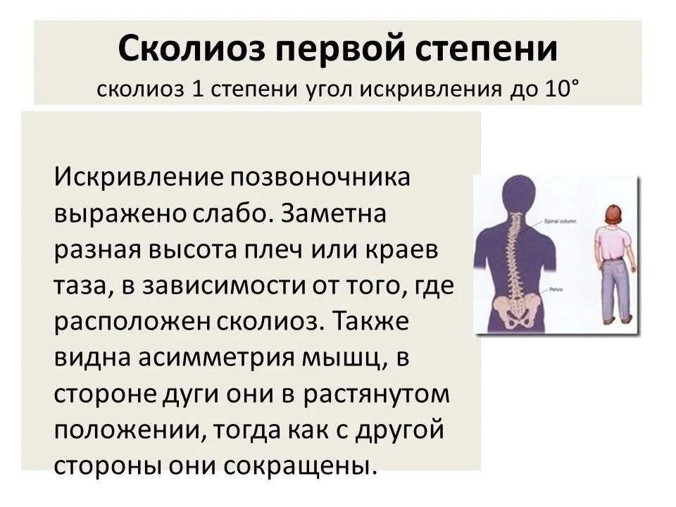 Сколиоз 2 степени это. Сколиоз 1 степени. Искривление позвоночника 1 степени. Симптомы сколиоза 1 степени. Правосторонний сколиоз 1 степени.