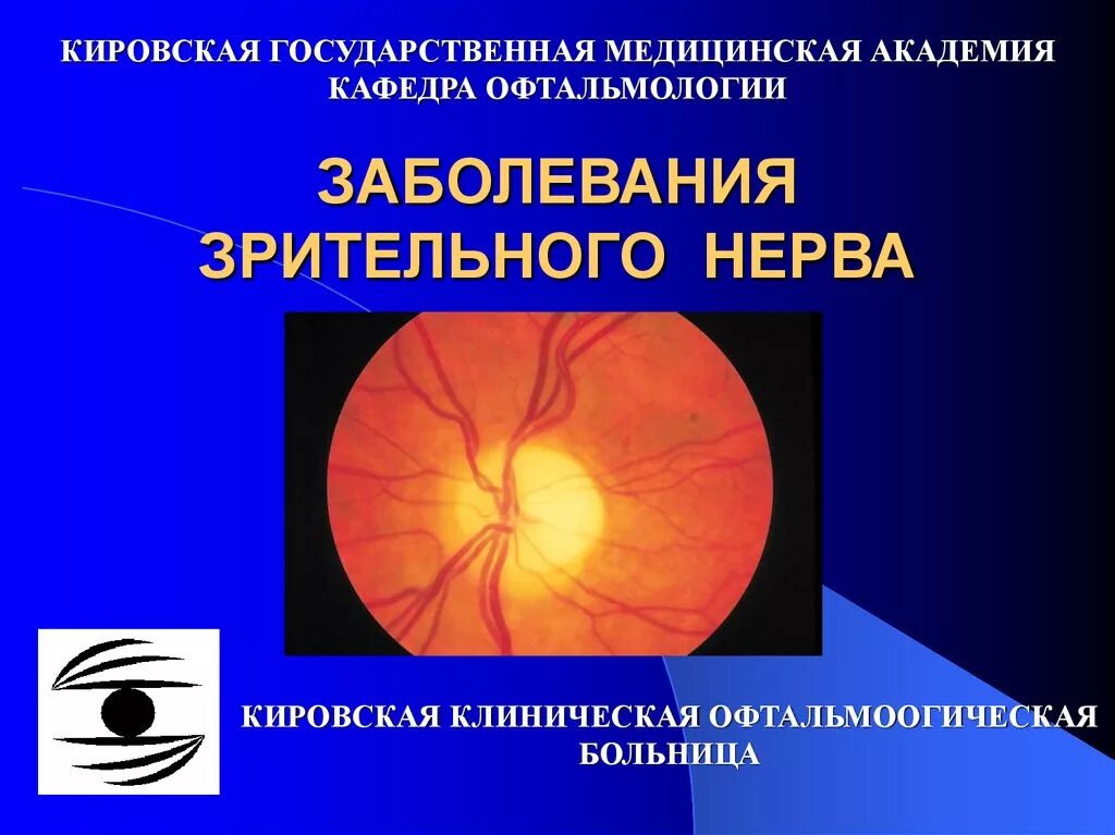 Заболевания зрительного нерва. Патология зрительного нерва. Дистрофические поражения зрительного нерва. Патология глазного нерва. Тип зрительного нерва