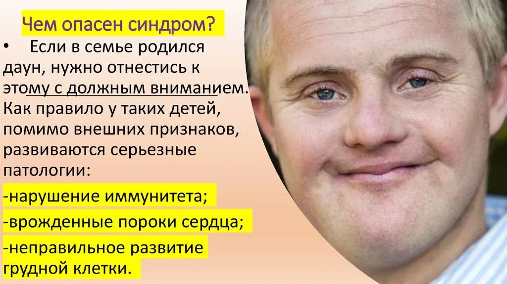 Что такое синдром опасна. Синдром дауна презентация. синдром дауна внешние признаки. синдром дауна картинки для презентации.