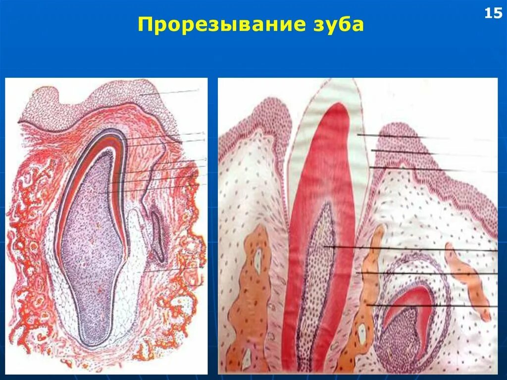 Гистогенез гистология. Стадии развития зуба гистология. Поздняя стадия развития зуба. Поздняя стадия развития зуба гистология. Развитие зубов у человека