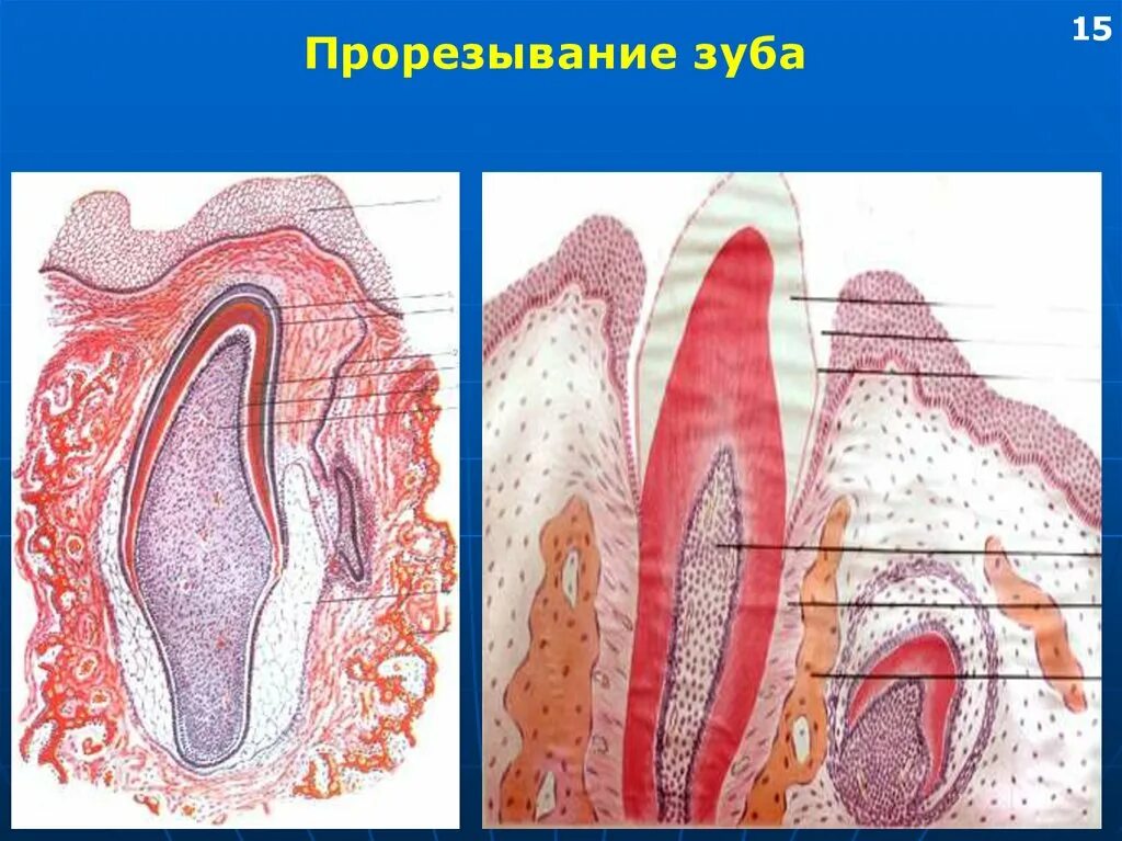 Стадии развития зуба. Поздняя стадия развития зуба гистология. Гистогенез гистология. Стадии развития зуба гистология. Развитие зуба гистология.