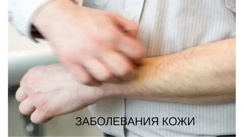 Почечный зуд