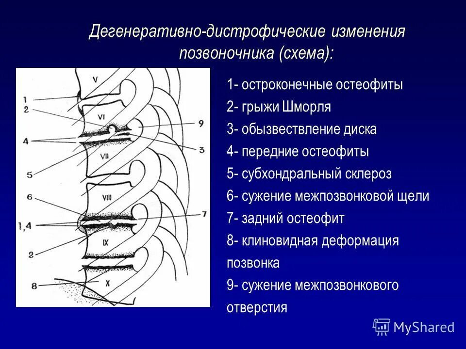 Дегенеративно-дистрофические изменения позвоночника что это. Дистрофические изменения грудного отдела. Дегенеративные изменения в позвонках. Дегенеративнодистофические изменения..