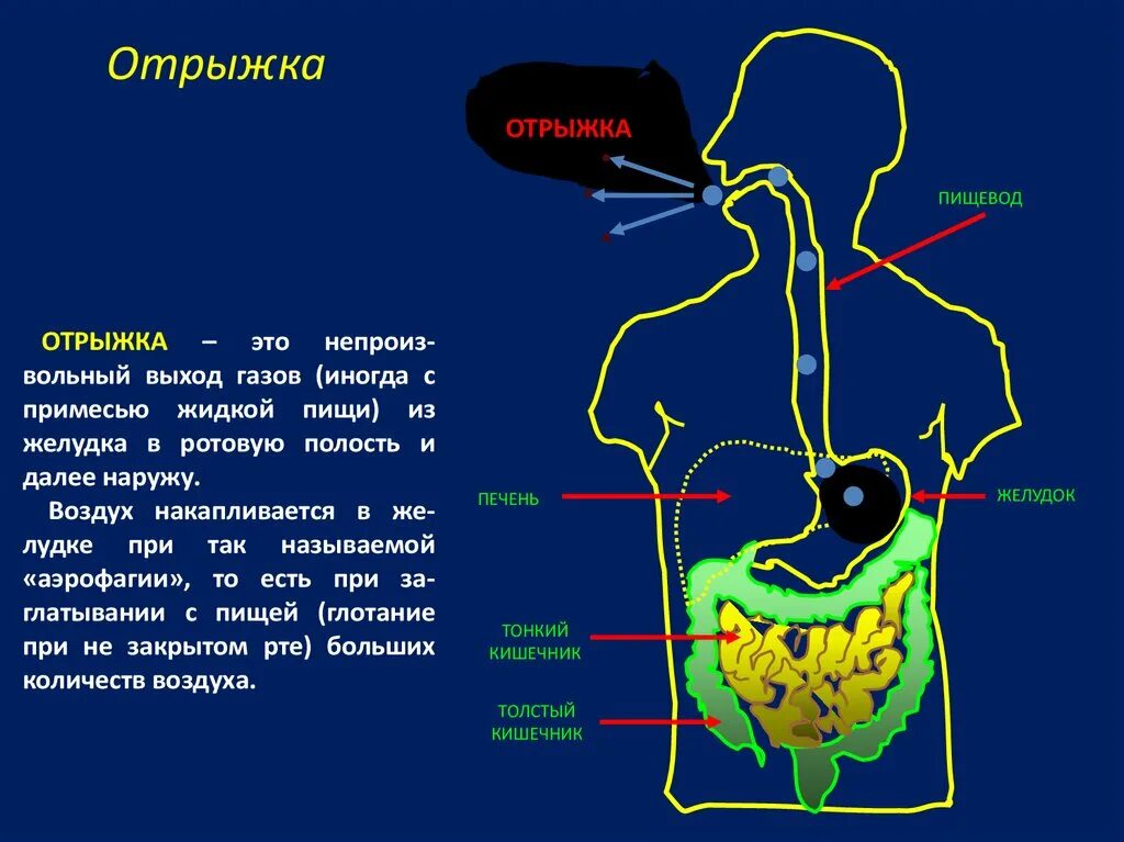 Сильная отрыжка желудок. Попадание воздуха в желудок. Ощущение воздуха в желудке. Воздух в желудке и кишечнике. Причины попадания воздуха в желудок.