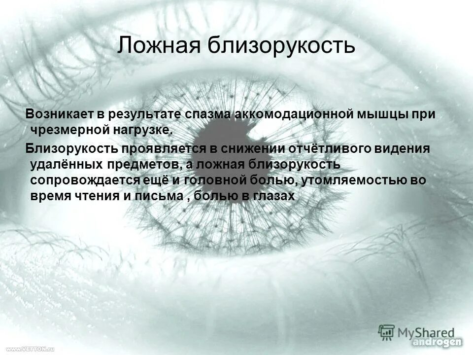 Ли спазм аккомодации. Ложная близорукость. Ложная миопия. Ложная миопия причины. Ложная близорукость симптомы.