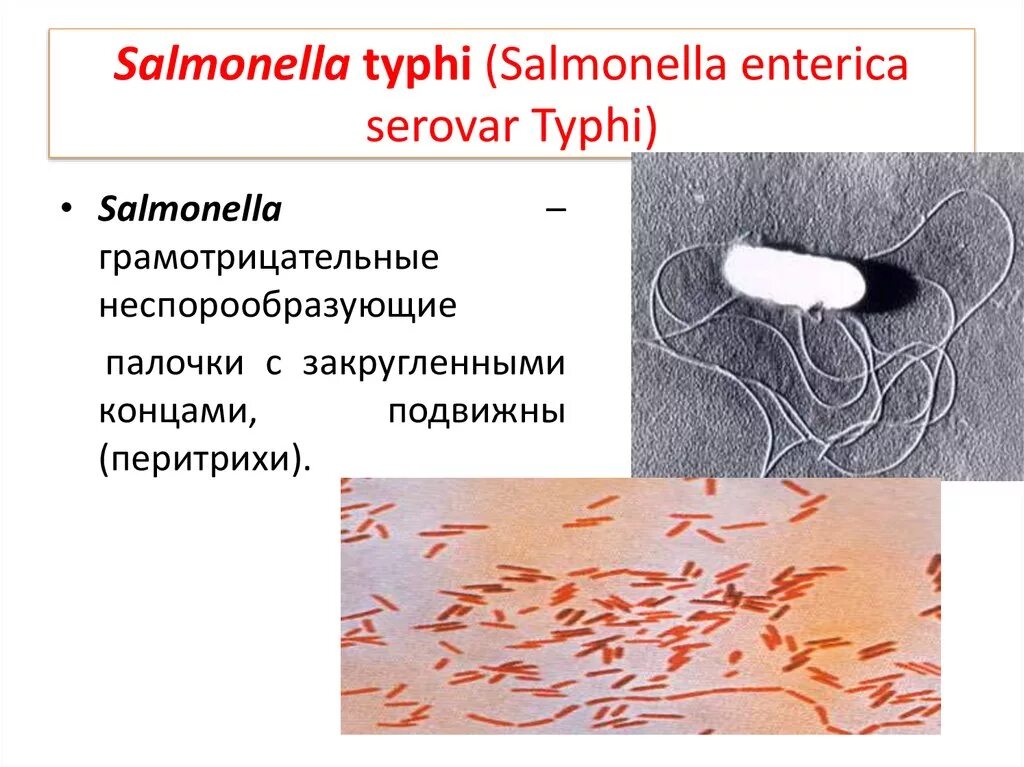 Сальмонелла брюшного тифа бактерия. Вибрионы сальмонелла. Брюшной тиф возбудитель бактерия. Бактерии рода сальмонелла. Сальмонеллез и брюшной тиф