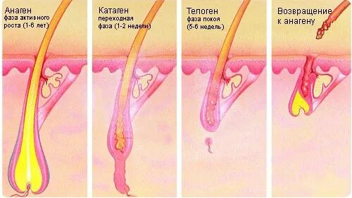 Им выпадать еще в. Им выпадать еще в. Очаговая алопеция (alopecia areata). Ровные зубы у детей. Очаговая алопеция (alopecia areata).