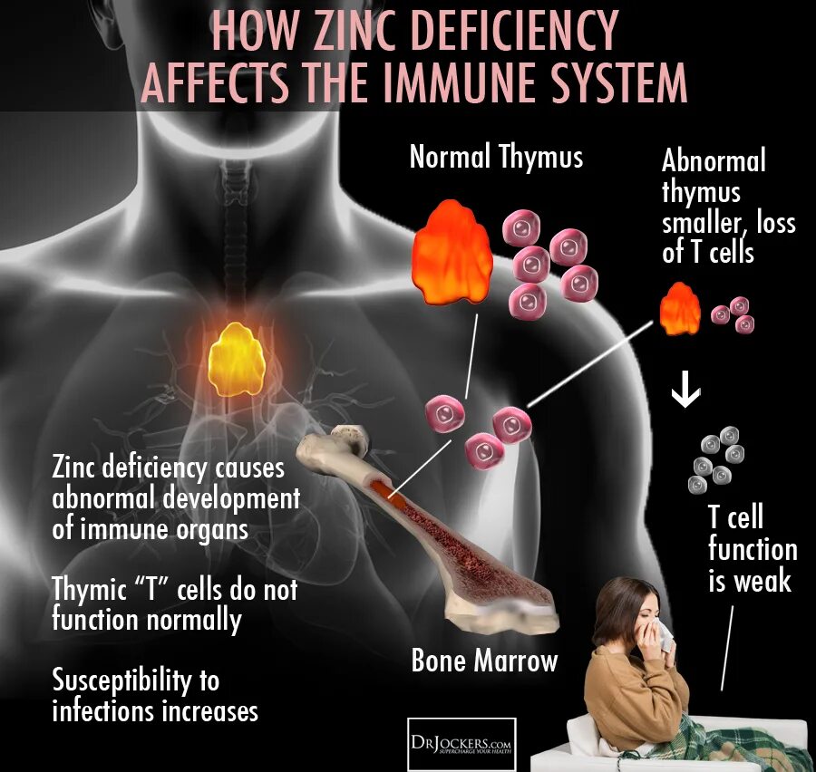 Иммунная система человека. Цинк для иммунной системы. Иммунная система человека фото.