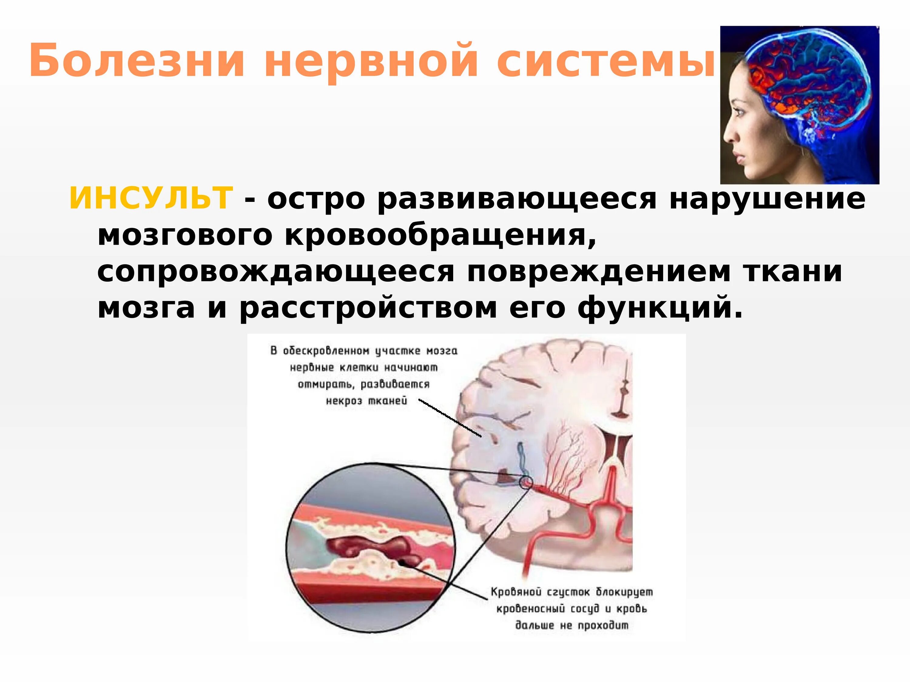 Основные причины нарушения нервной системы. Заболевания нервной системы. Заболевания нервной системы человека. Нарушения нервной системы заболевания. Наиболее распространенные заболевания нервной системы.