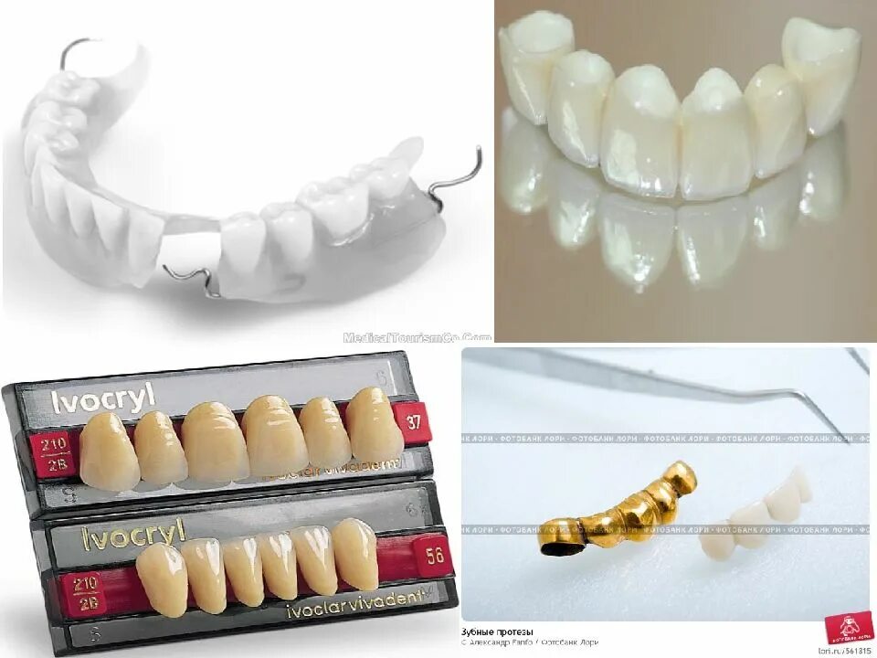 Искусственные зубы. Пластмассовые искусственные зубы. Искусственные зубы для протезов. Фарфоровые искусственные зубы.