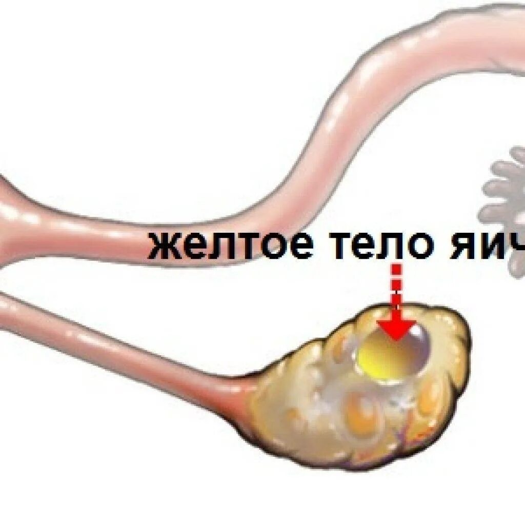 Фолликулярная и желтое тело киста яичника. Киста желтого тела 8 см левого яичника. Киста желтого тела яичника клинические рекомендации. Киста желтого тела и фолликулярная киста.