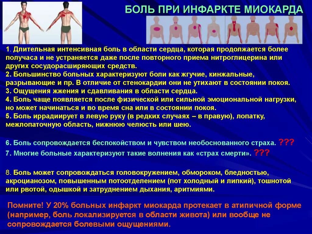 Сколько времени длится боль. Боль при инфаркте миокарда. Локализация боли при инфаркте. Инфаркт миокарда локализация боли. Боли при остром инфаркте миокарда.