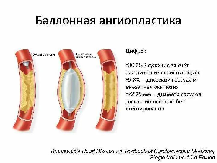 Препараты после стентирования