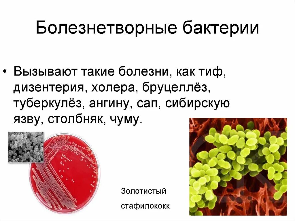 Болезнетворные бактерии биология. Болезнетворные бактерии. Болезни вызываемые бактериями 5 класс. Заболевания человека вызываемые микроорганизмами. Болезнетворные бактерии вызывают.