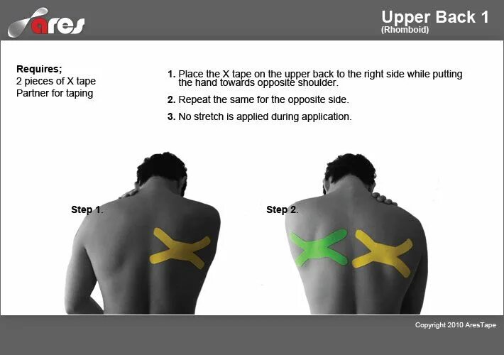 Схема боли в спине. Тейпирование при болях в спине схемы. Тейпирование лопаток при болях в спине. Тейп на верхнюю часть спины. Тейп на спину верхняя часть спины.
