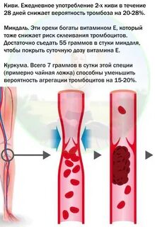 Сок тромбы