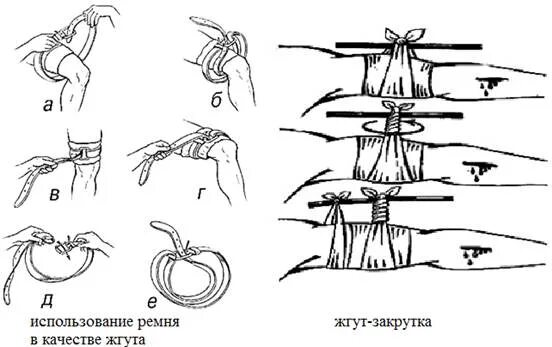 Наложение табельного жгута. Жгут для остановки артериального кровотечения. Наложение закрутки при артериальном кровотечении. Наложение жгута при кровотечениях.