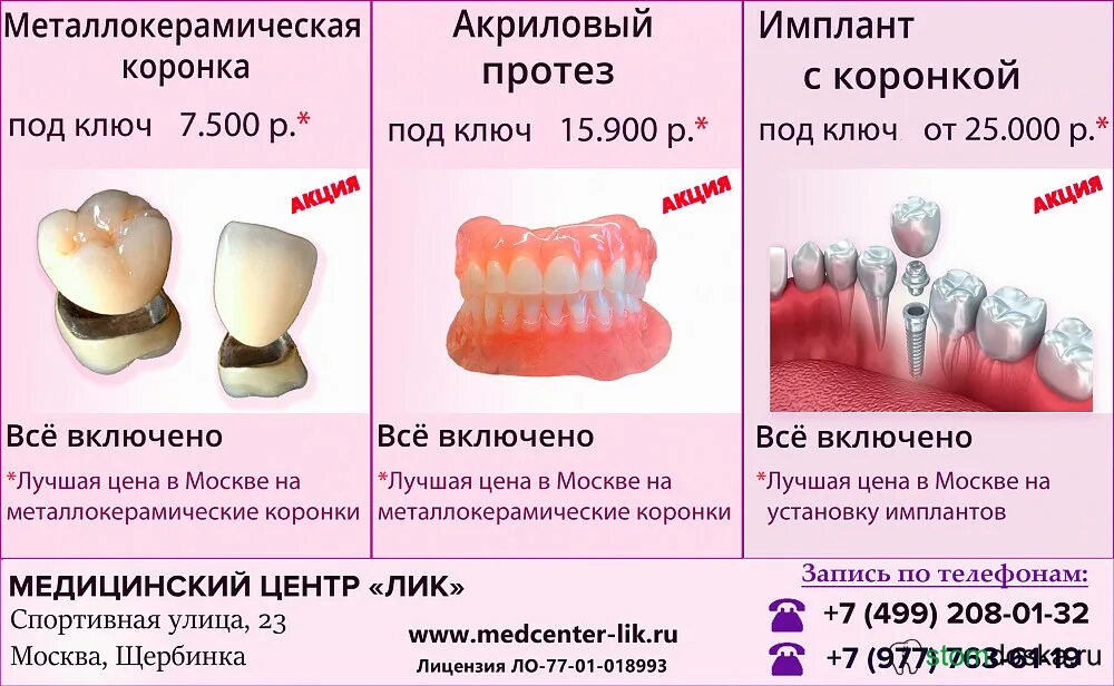 Сколько стоит снимать зуб. Зубные протезы импланты. Коронки протезы импланты. Зубные коронки на импланты. Имплант с коронкой под ключ.