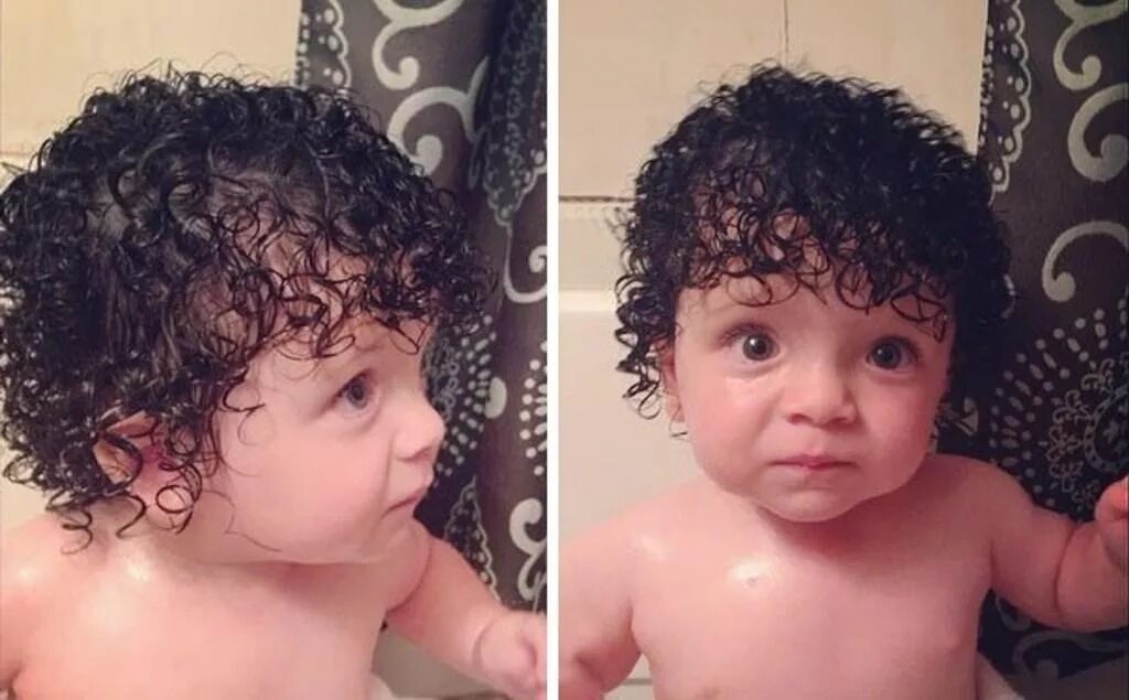 Фазы роста волос анаген. Как рождается волос. Волосяные фолликулы кожи. Гидраденит фурункулез. Как рождается волос.