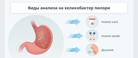Какие анализы сдают на хеликобактер желудка