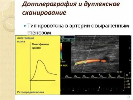 Доплер сканирование