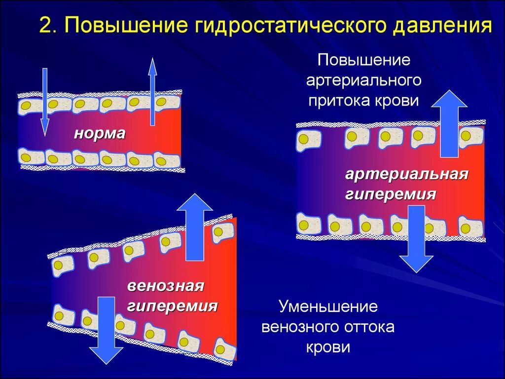 Увеличение гидростатического давления. Гидростатическое давление крови. Повышенное гидростатическое давление. Гидростатическое и онкотическое давление в капилляре.