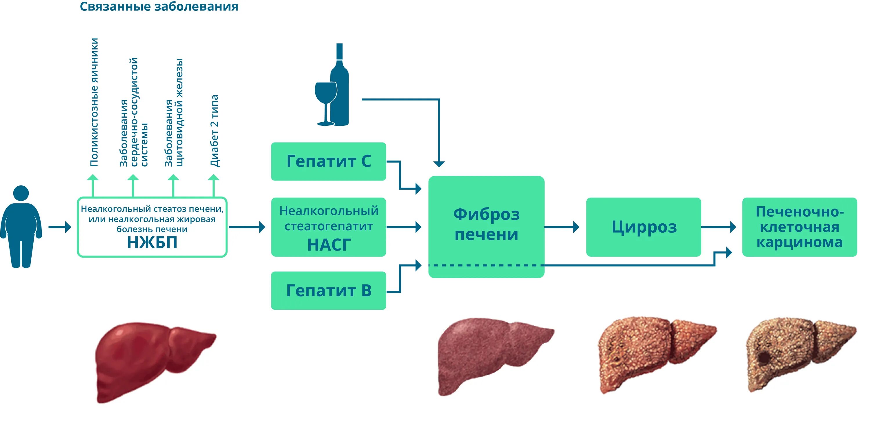 Признаки стеатоза печени. Схема лекарств при стеатозе печени. Стадии стеатоза печени. Болезнь печени стеатогепатоз.