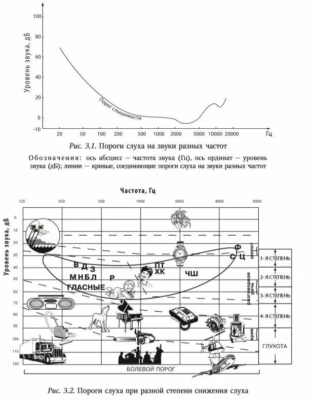 Слух децибелы