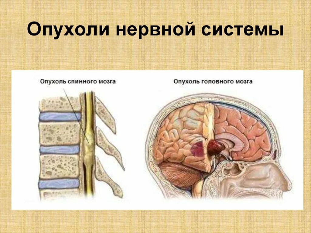 Оттек головного мозга