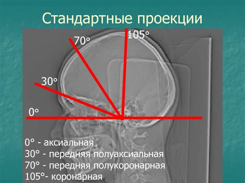 Аксиальная проекция челюсти. Аксиальная проекция. аксиальная проекция кт. аксиальная проекция рентген. рентгенография черепа в аксиальной проекции.