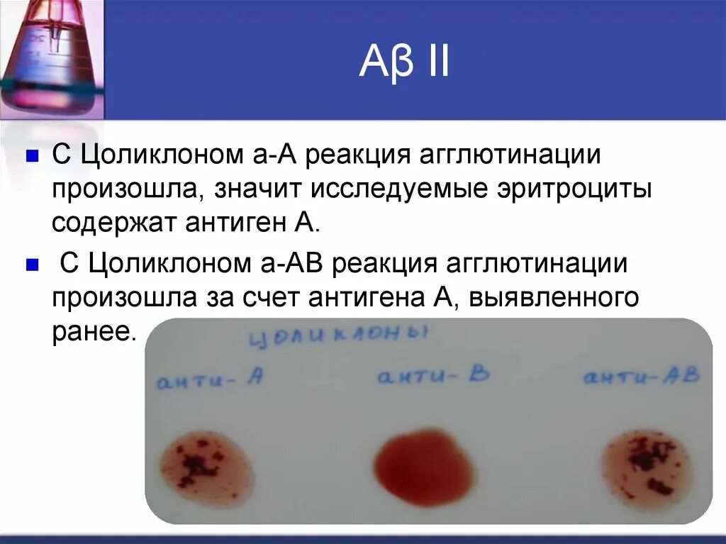 Реакция агглютинации эритроцитов. Цоликлон анти д агглютинация. Цоликлоны реакция. Агглютинация эритроцитов с цоликлонами. Моноклональные антитела Цоликлоны.