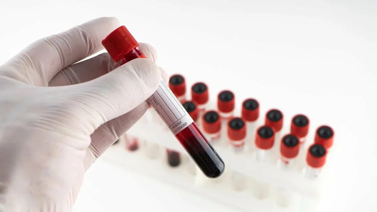 Тест капля крови. Rhjdm d ghj,bhrtгиф. Медицинские пробирки. Исследование крови. Пробирки с кровью в лаборатории.