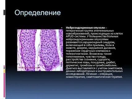 Эпителиальная неоплазия