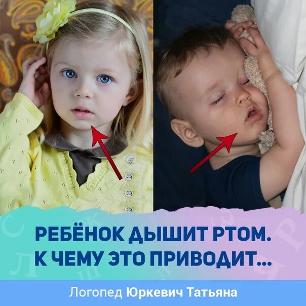 Сплю дышу ртом. Ребенок дышит. Ребенок часто выдыхает ртом.