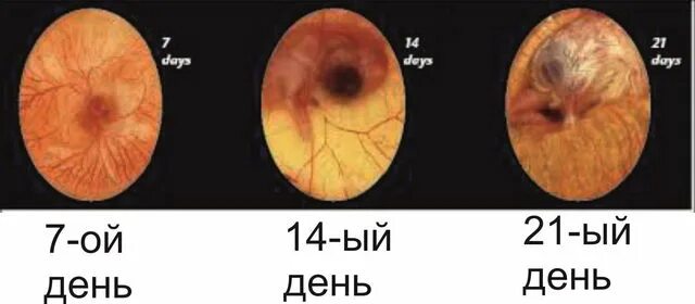 21 день инкубации. Цыпленок в яйце на 14 день инкубации. 14 День инкубации куриных яиц. Эмбрион цыпленка в яйце на 7 сутки.