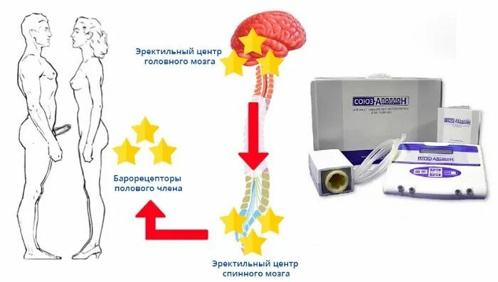 Инструкция применения аппарата союз аполлон. Прибор союз-аполлон для потенции.. прибор прибор союз аполлон для мужчин.