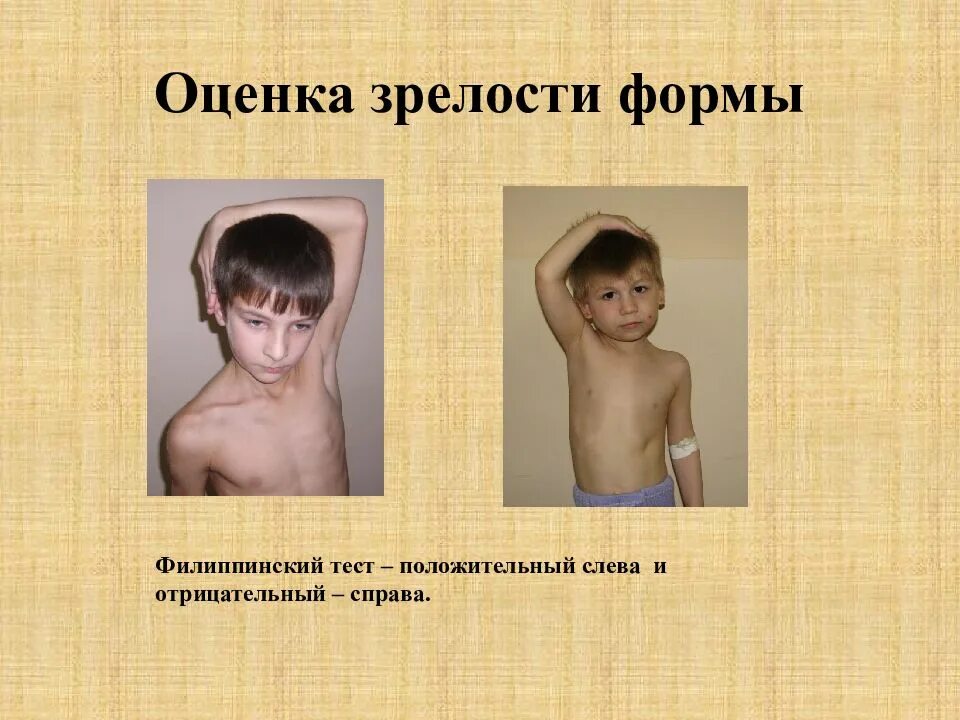 О чем может сообщить филиппинский тест. Филиппинский тест. филиппинский тест готовности ребенка к школе. филиппинский тест на готовность. проведение и оценка филиппинского теста у детей.