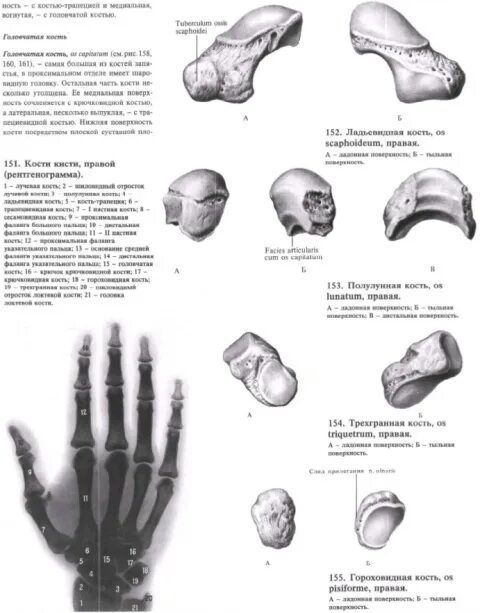 Carpal bone fractures